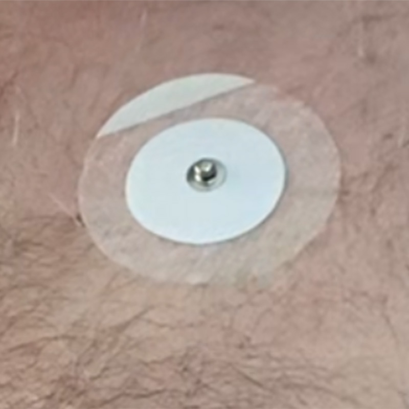 ECG Electrode Pad on Chest
